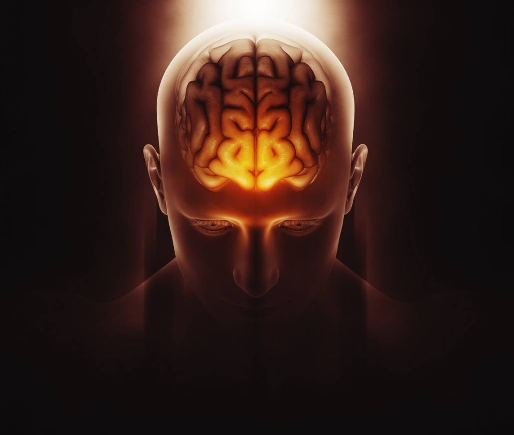 Bipolar3 Bipolar 3